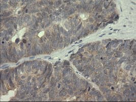 SERPINB3 Antibody (clone OTI3C2)