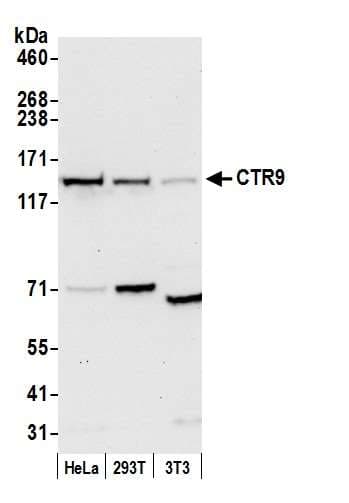 Polyclonal Rabbit anti-Human CTR9 Antibody (aa1123-1173, IHC, WB)