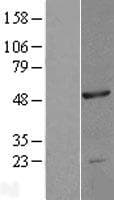 NOB1 / NOB1P Protein (Over-Expression Lysate Myc-DDK (Flag))