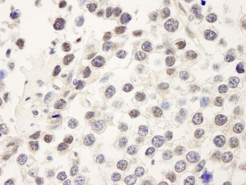 Polyclonal Rabbit anti-Human CDC25C Antibody (aa150-200, IHC)