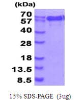 Human NMT1 Protein (Recombinant His)