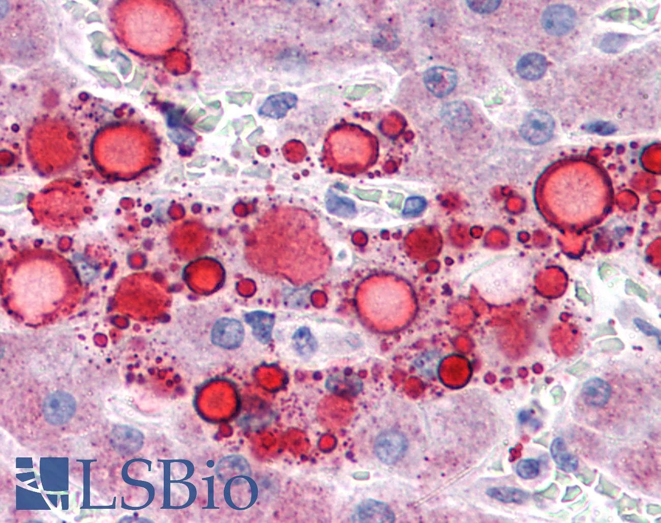 PathPlus™ Polyclonal Rabbit anti-Human PLIN2 / ADFP / Adipophilin Antibody (IHC, WB)