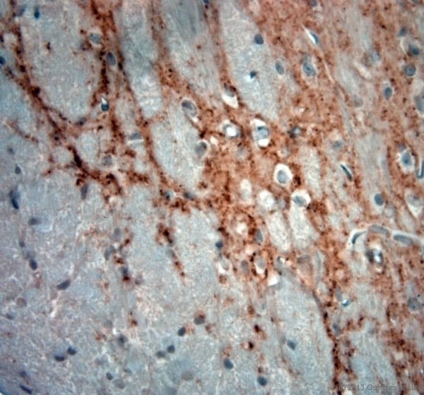 GAD 65+67 Antibody (aa530-600)