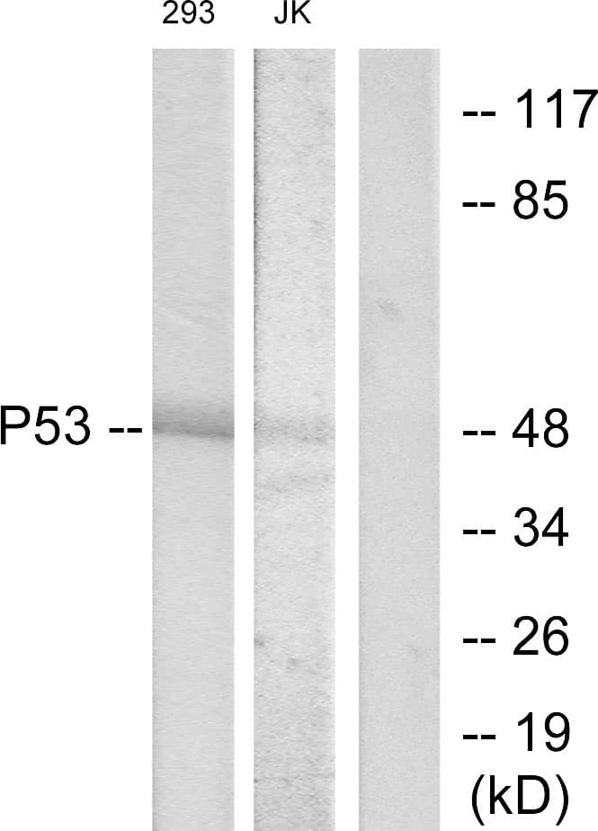 TP53 / p53 Antibody (aa16-65)