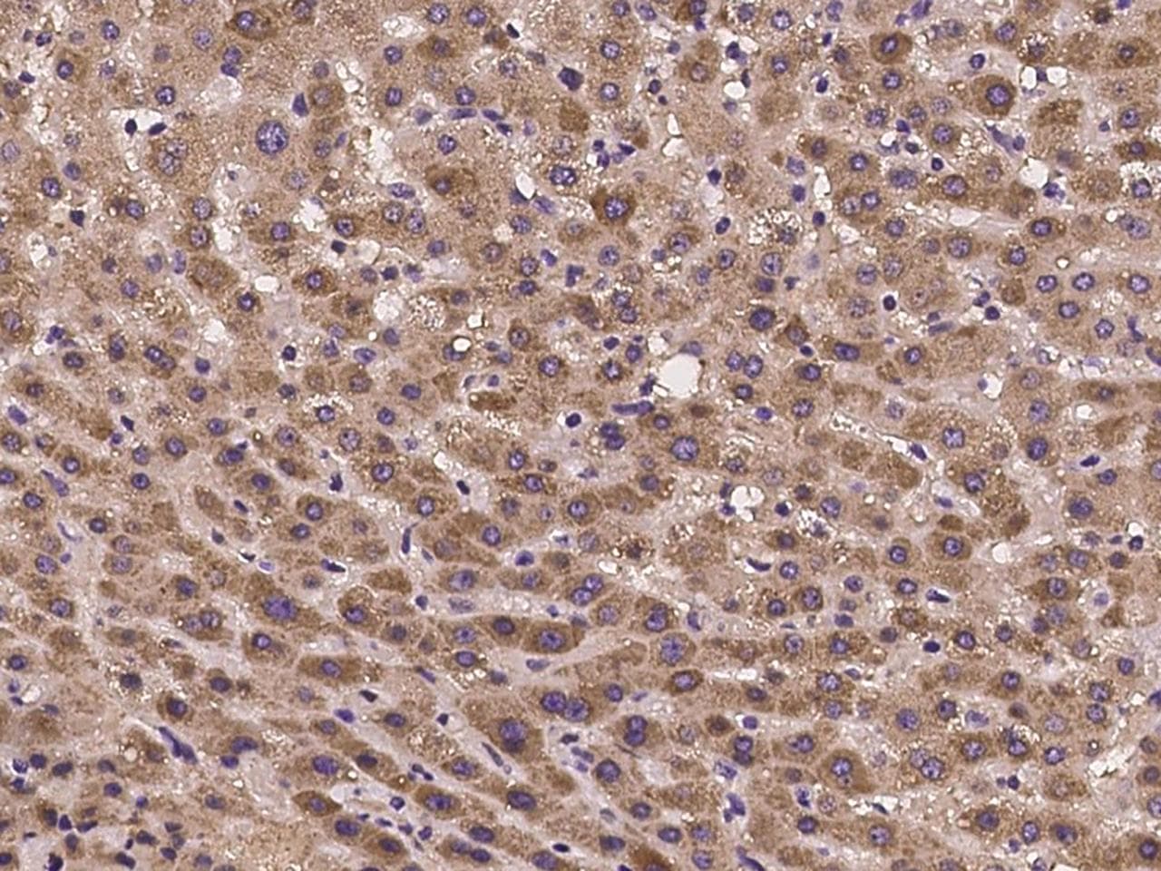 Polyclonal Rabbit anti-Human HRG Antibody (IHC)