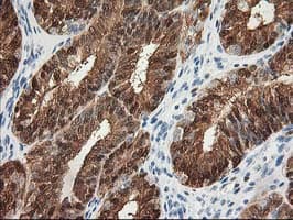 Monoclonal Mouse anti-Human 15-PGDH / HPGD Antibody (clone OTI2F5, IHC, WB)