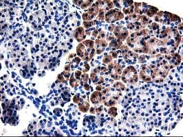 TBC1D21 Antibody (clone OTI3F1)