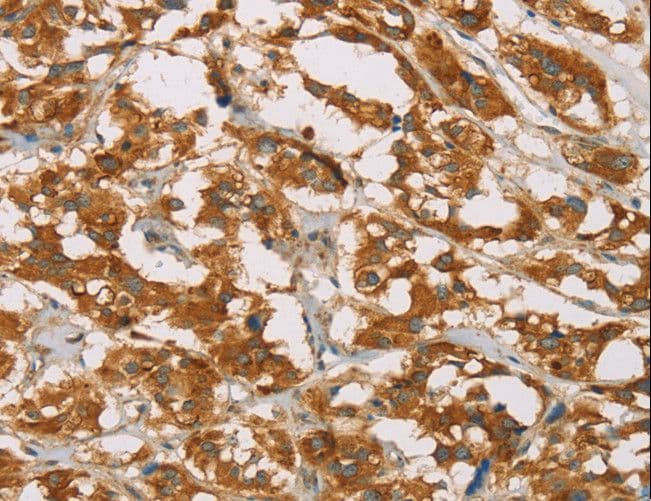 IHC-plus™ Polyclonal Rabbit anti-Human DLL4 Antibody (IHC)