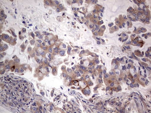 Monoclonal Mouse anti-Human PKM2 Antibody (clone 11B11, IHC, WB)