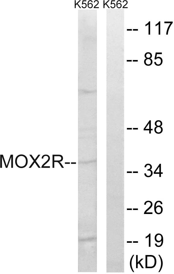 CD200R1 / CD200R Antibody (aa241-290)