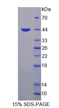 Human HIPK4 Protein (Recombinant His, N-Terminal)