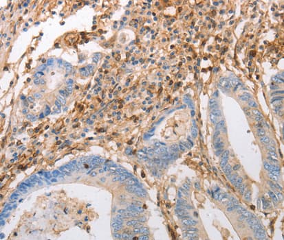 Polyclonal Rabbit anti-Human INA / Alpha Internexin Antibody (IHC, WB)