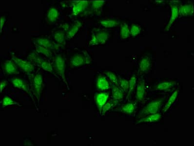 Polyclonal Rabbit anti-Human HOXD12 Antibody (IF)