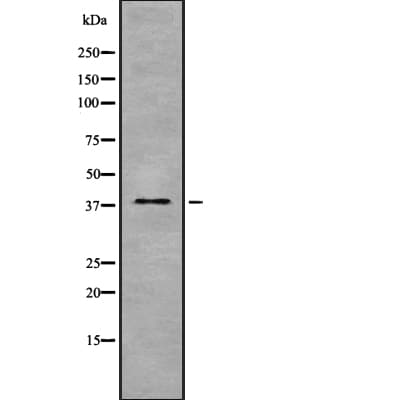 GPD1 Antibody