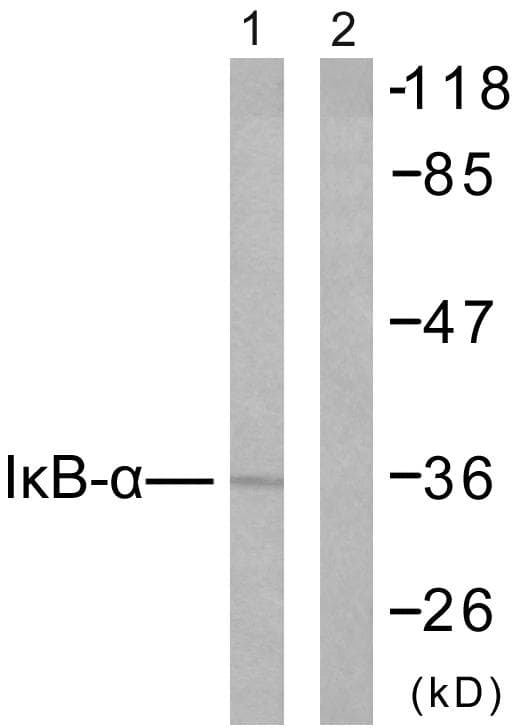 NFKBIA / IKB Alpha / IKBA Antibody (p42)