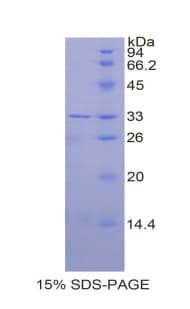Human CA2 / Carbonic Anhydrase II Protein (Recombinant His)