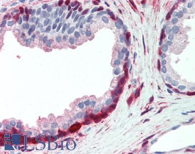 Polyclonal Rabbit anti-Human ANTXR2 / CMG2 Antibody (aa34-318, IHC, WB)