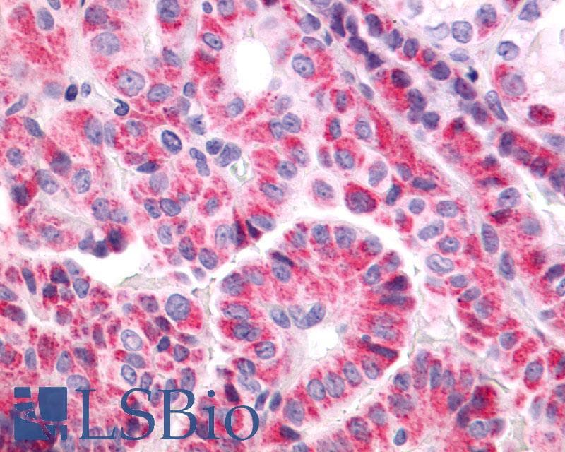 PathPlus™ Polyclonal Rabbit anti-Human TSH Receptor / TSHR Antibody (C-Terminus, IHC)