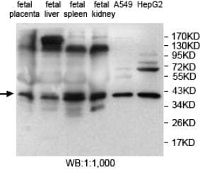 PLAC1 Antibody (aa26-192)