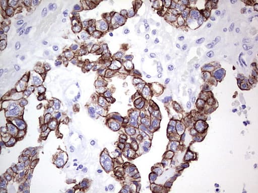 Monoclonal Mouse anti-Human KRT19 / CK19 / Cytokeratin 19 Antibody (clone OTI5F4, aa240-390, IHC, WB)
