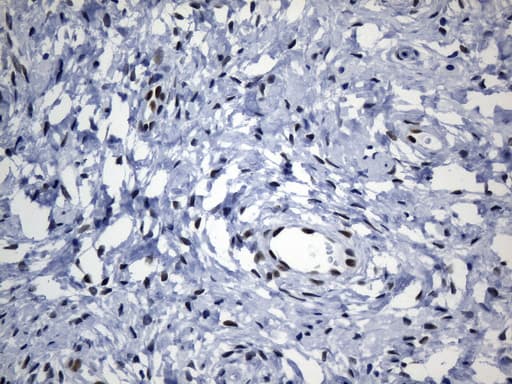 TLE1 / TLE 1 Antibody (aa180-460, clone UMAB253, Carrier-free)