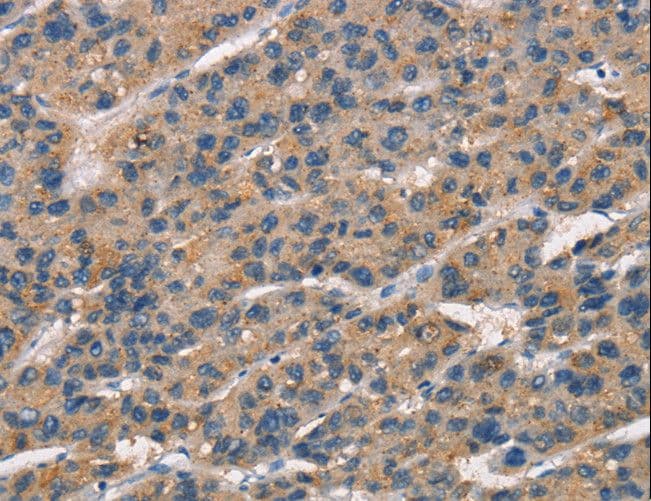 SENP1 Antibody