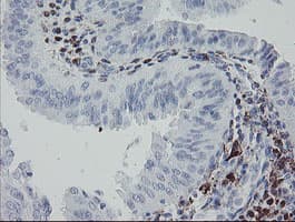 F13A1 / Factor XIIIa Antibody (clone OTI9E2)