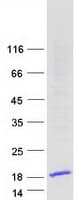 Human HMGN3 Protein (Recombinant Myc-DDK (Flag))