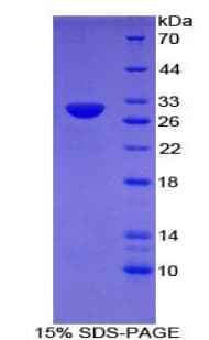 Mouse TLR6 Protein (Recombinant His-T7)