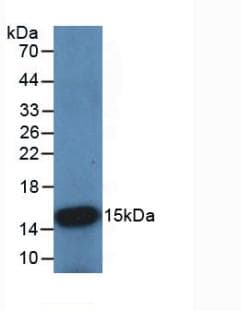CSTB / Cystatin B / Stefin B Antibody