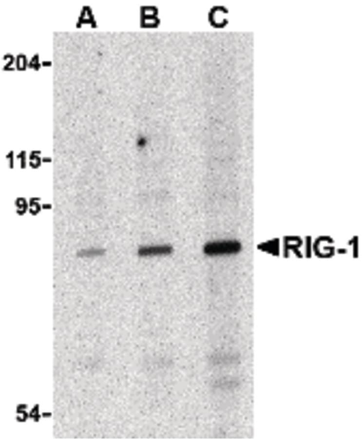 DDX58 / RIG-1 / RIG-I Antibody