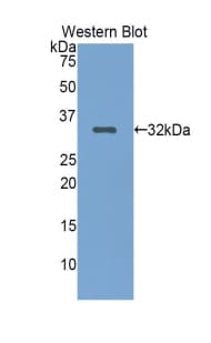 LRP5 Antibody (aa769-1016)