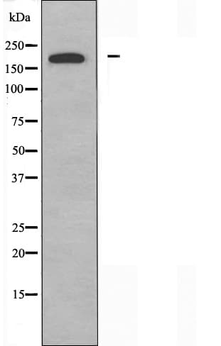 DOCK180 / DOCK1 Antibody
