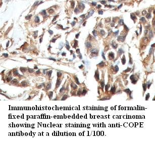 Polyclonal Rabbit anti-Human COPE Antibody (IHC, WB)