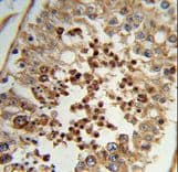 TC2N Antibody (aa3-30)
