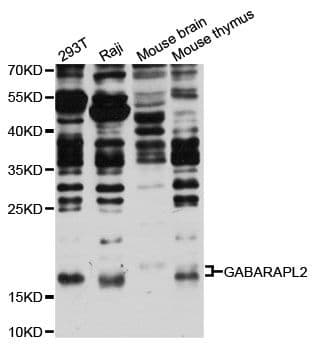 Polyclonal Rabbit anti-Human GABARAPL2 / ATG8 Antibody (WB)