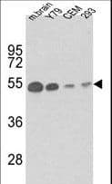 Monoclonal Mouse anti-Human TUBB1 / Tubulin Beta 1 Antibody (IHC, IF, WB)