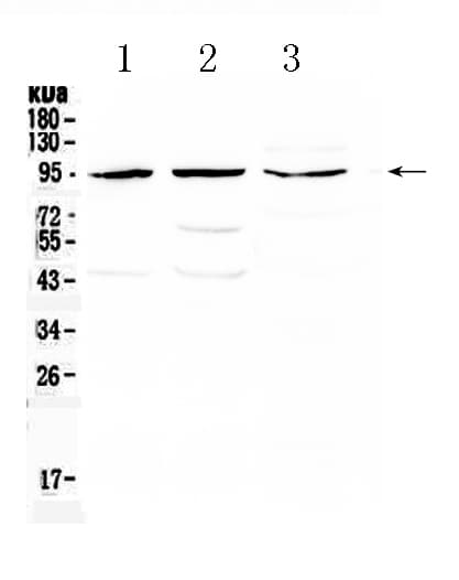 Polyclonal Rabbit anti-Human CD105 Antibody (WB)