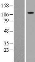 SPECC1 / CYTSB Protein (Over-Expression Lysate Myc-DDK (Flag))
