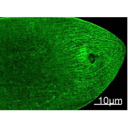 Myosin Heavy Chain Antibody (clone 11C2)