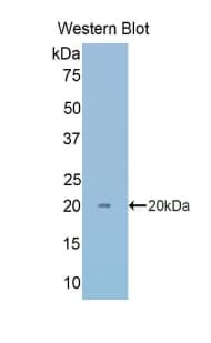 CA7 / Carbonic Anhydrase VII Antibody (aa29-173)