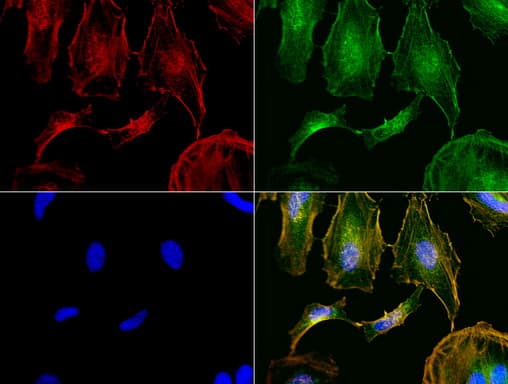 NME1 / NM23 Antibody (clone UMAB91, Carrier-free)