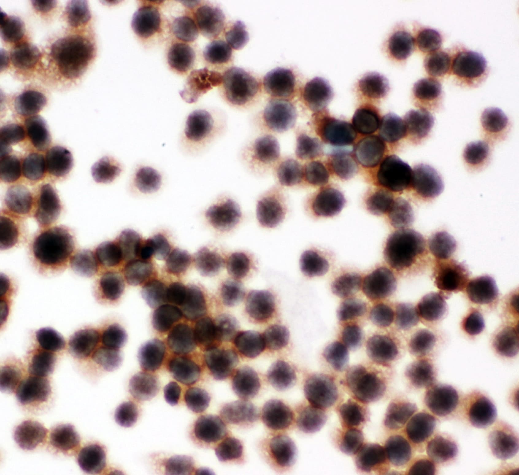 CD45 / LCA Antibody (aa1209-1227)