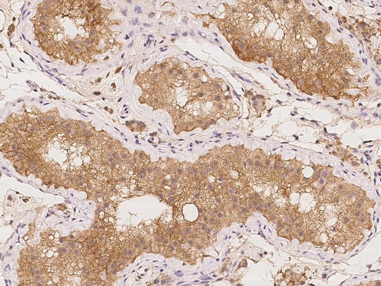 TTC12 Antibody