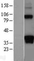 DAZL Protein (Over-Expression Lysate Myc-DDK (Flag))