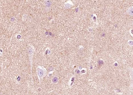 NGF Antibody