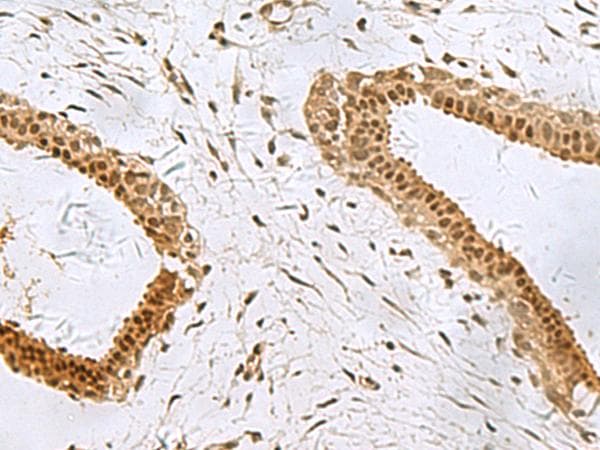 PCBD1 / PHS Antibody