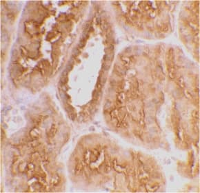 ACE2 / ACE-2 Antibody