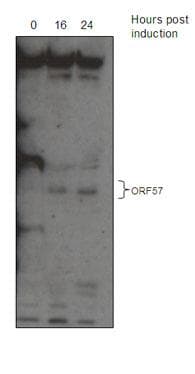 Polyclonal Rabbit anti-Human Herpesvirus 8 HHV-8 ORF57 Antibody (aa33-60, WB)