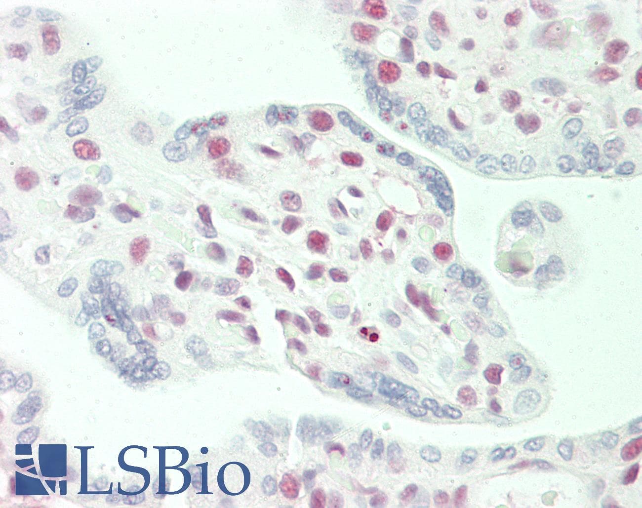 IHC-plus™ STAG2 Antibody (aa1125-1175)